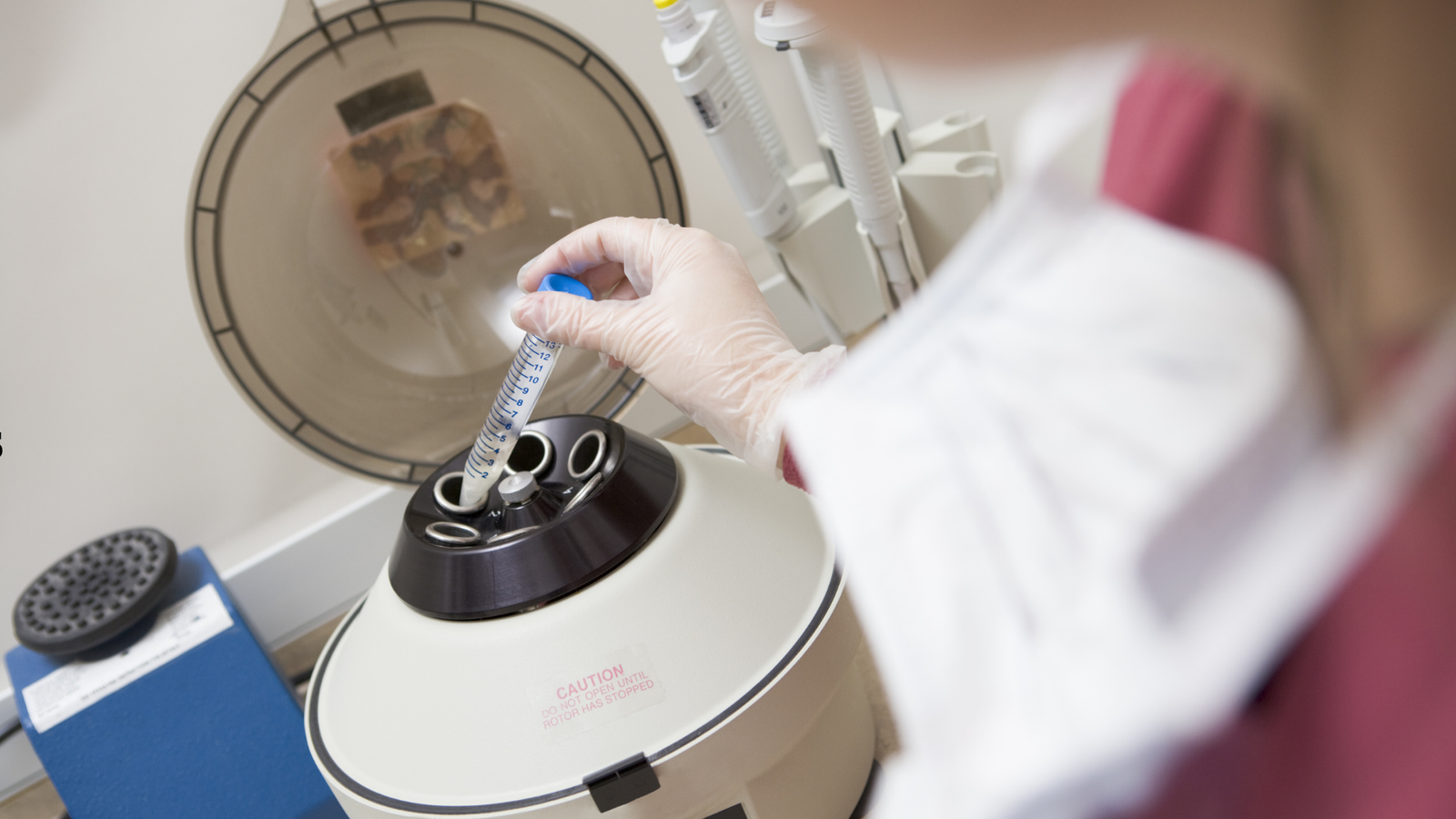 PGD in Georgia (Tbilisi) is embryo genetic testing performed during IVF to reduce the risk of transferring embryos affected by specific inherited conditions. Learn the PGD process step by step, who benefits, timeline for international patients, and key success factors.